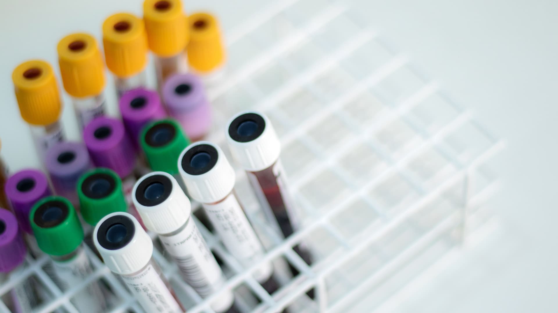 Exame Particular com Descontos Especiais no Pretti image