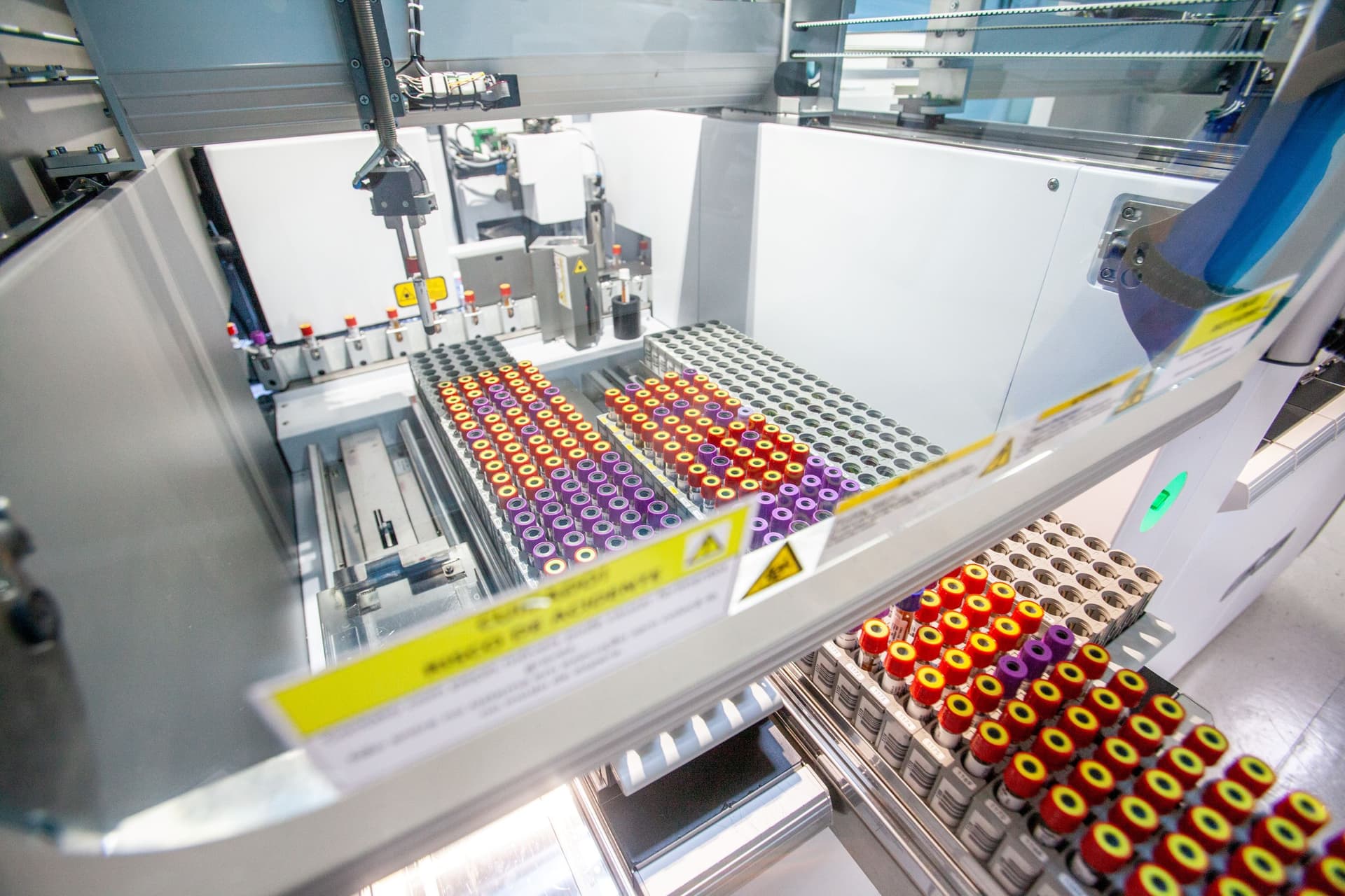 PSA Total: O Que É, Quando É Indicado o Exame e Mais image